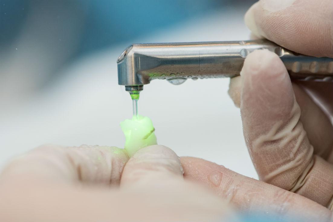 Laser Dentistry Cerritos, CA
