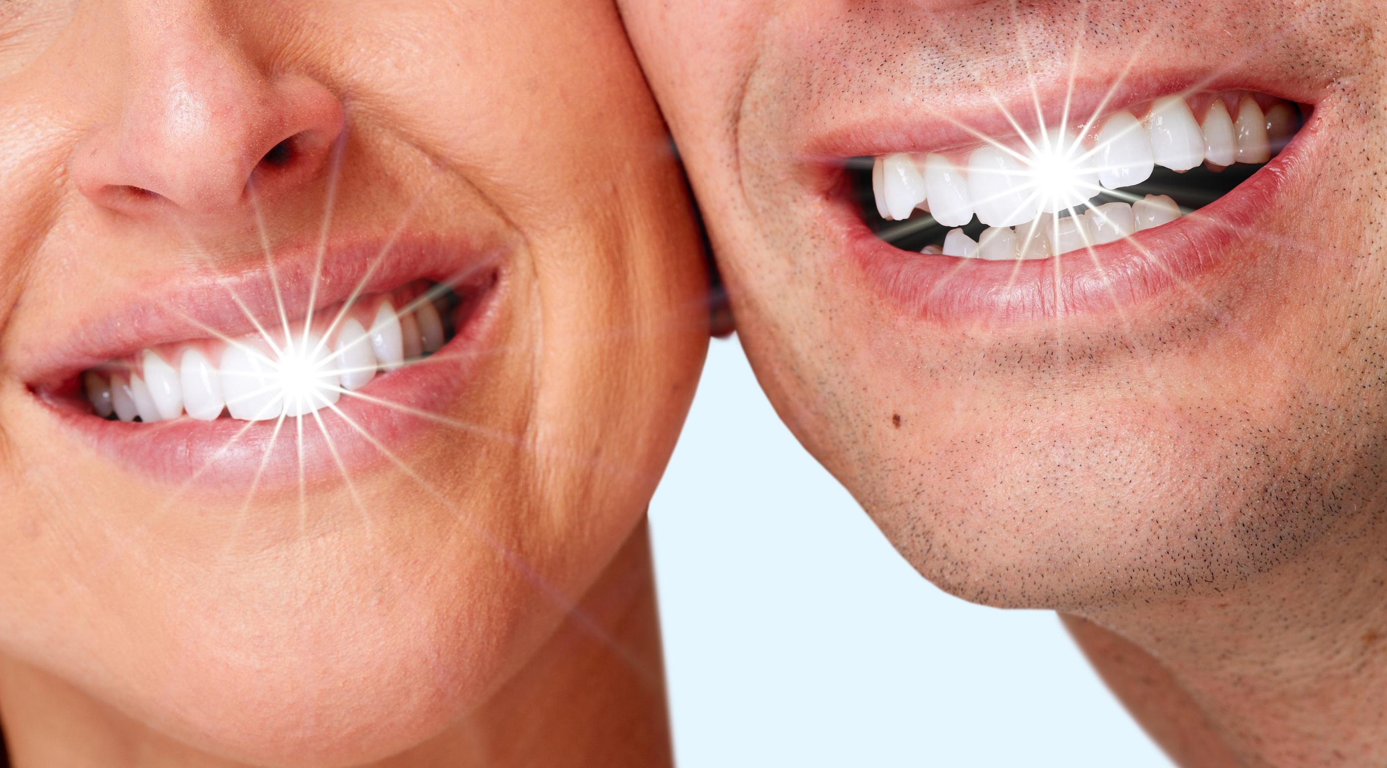 Teeth Whitening Cerritos, CA